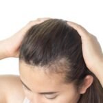 علاج تساقط الشعر وتقوية البصيلا