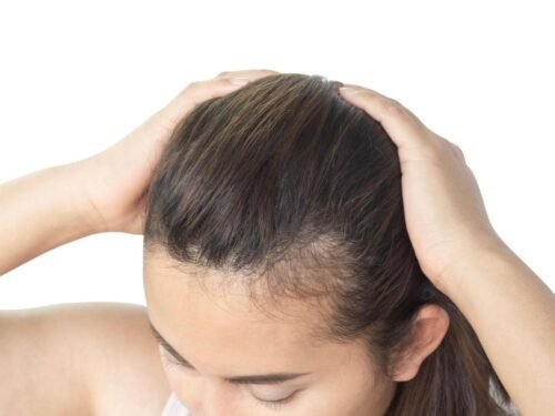 علاج تساقط الشعر وتقوية البصيلا علاج تساقط الشعر وتقوية البصيلا