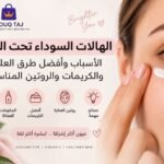 علاج الهالات السوداء تحت العين